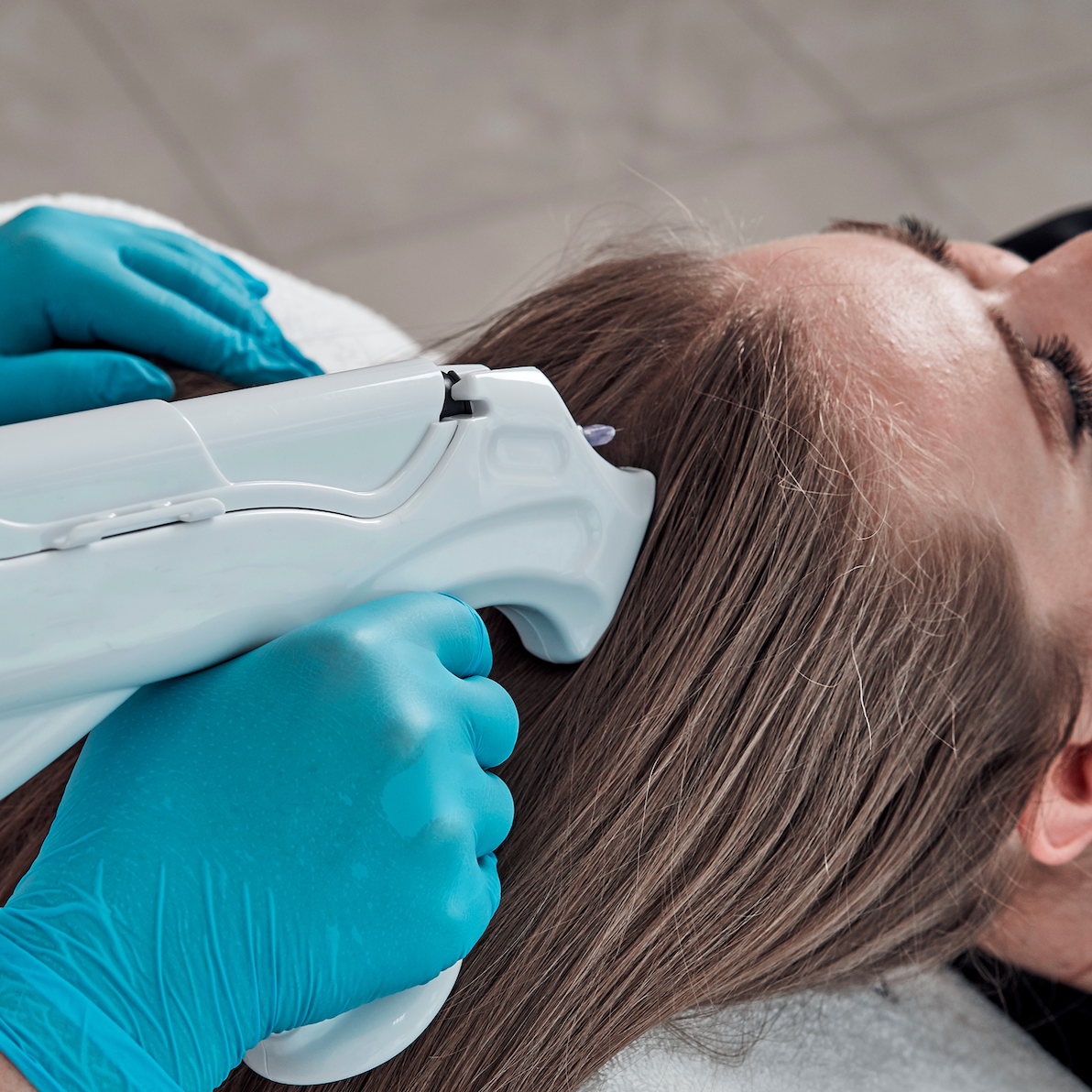 Mesotherapie für Haarwachstum