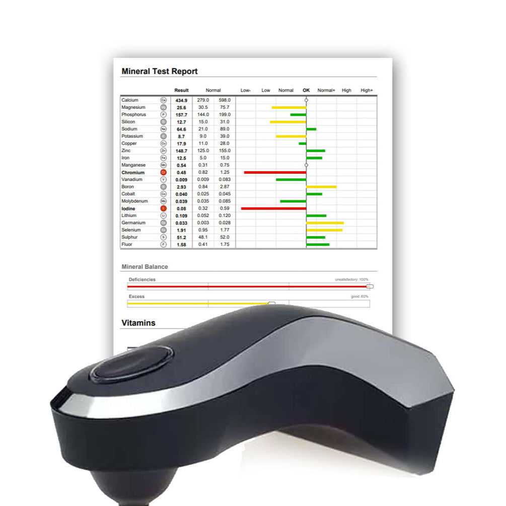 Vitality Chek - Analyse